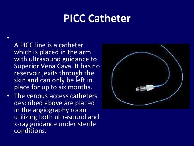 PermacathPlacement under US guaidance DR. muhammad Bin Zulfiqar
