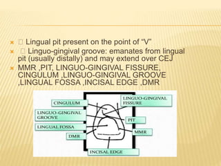  Lingual pit present on the point of “V”
 Linguo-gingival groove: emanates from lingual
pit (usually distally) and may extend over CEJ
 MMR ,PIT, LINGUO-GINGIVAL FISSURE,
CINGULUM ,LINGUO-GINGIVAL GROOVE
,LINGUAL FOSSA ,INCISAL EDGE ,DMR
 