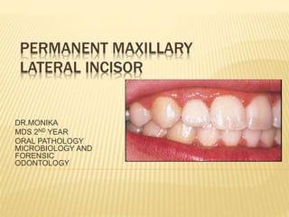 PERMANENT MAXILLARY
LATERAL INCISOR
DR.MONIKA
MDS 2ND YEAR
ORAL PATHOLOGY
MICROBIOLOGY AND
FORENSIC
ODONTOLOGY
 