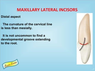 7
Distal aspect
The curvature of the cervical line
is less than mesially.
It is not uncommon to find a
developmental groove extending
to the root.
MAXILLARY LATERAL INCISORS
 