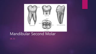 Mandibular Second Molar
18, 31
 