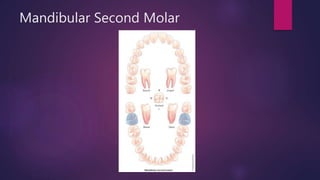 Mandibular Second Molar
 
