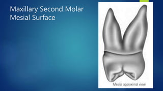 Permanent posterior teeth maxillary first, second and third molars | PPTX