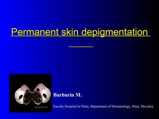 Permanent skin depigmentation   Barbarin M. Faculty Hospital in Nitra, Department of Dermatology, Nitra, Slovakia 