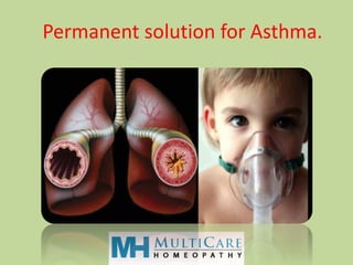 Permanent solution for Asthma.
 