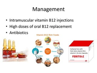pernicious anemia vitamin b12 injections Pernicious Anemia: Genomics and B12 Deficiency main image 0