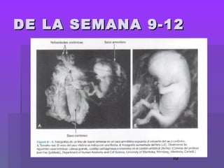 10
DE LA SEMANA 9-12DE LA SEMANA 9-12
 