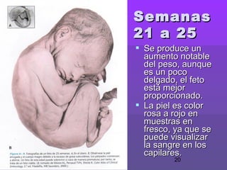 20
SemanasSemanas
21 a 2521 a 25
 Se produce unSe produce un
aumento notableaumento notable
del peso, aunquedel peso, aunque
es un pocoes un poco
delgado, el fetodelgado, el feto
está mejorestá mejor
proporcionado.proporcionado.
 La piel es colorLa piel es color
rosa a rojo enrosa a rojo en
muestras enmuestras en
fresco, ya que sefresco, ya que se
puede visualizarpuede visualizar
la sangre en losla sangre en los
capilares.capilares.
 
