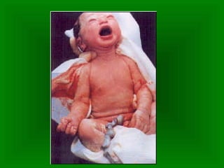 Período fetal