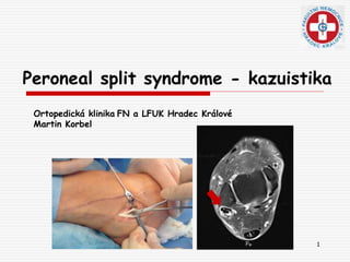 1
Peroneal split syndrome - kazuistika
Ortopedická klinika FN a LFUK Hradec Králové
Martin Korbel
 