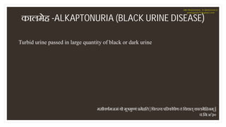 कालमेह -ALKAPTONURIA (BLACK URINE DISEASE)
मसीवणमज ं यो मू मु णं मेहित | िप य प रकोपेण तं िव ात् कालमेिहनम् ||
च.िन.४/३०
T...
