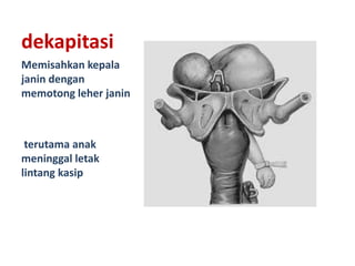 dekapitasi
Memisahkan kepala
janin dengan
memotong leher janin
terutama anak
meninggal letak
lintang kasip
 