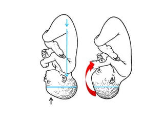 Persalinan normal (TAP).ppt Persalinan normal (TAP).ppt
