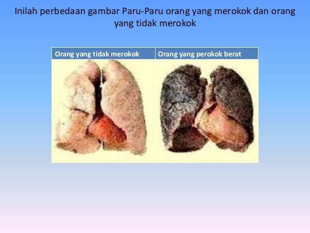 Persentasi Dilarang Merokok Gangguan Pernafasan 3 Inilah Perbedaan Gambar Tentang