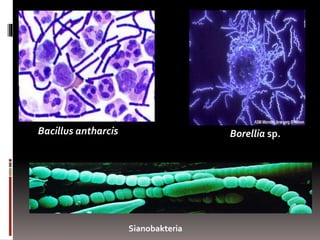 Borellia sp.
Sianobakteria
Bacillus antharcis
 