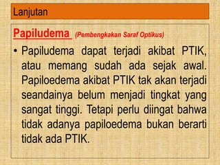 Papiludema (Pembengkakan Saraf Optikus)
• Papiludema dapat terjadi akibat PTIK,
atau memang sudah ada sejak awal.
Papiloedema akibat PTIK tak akan terjadi
seandainya belum menjadi tingkat yang
sangat tinggi. Tetapi perlu diingat bahwa
tidak adanya papiloedema bukan berarti
tidak ada PTIK.
Lanjutan
 