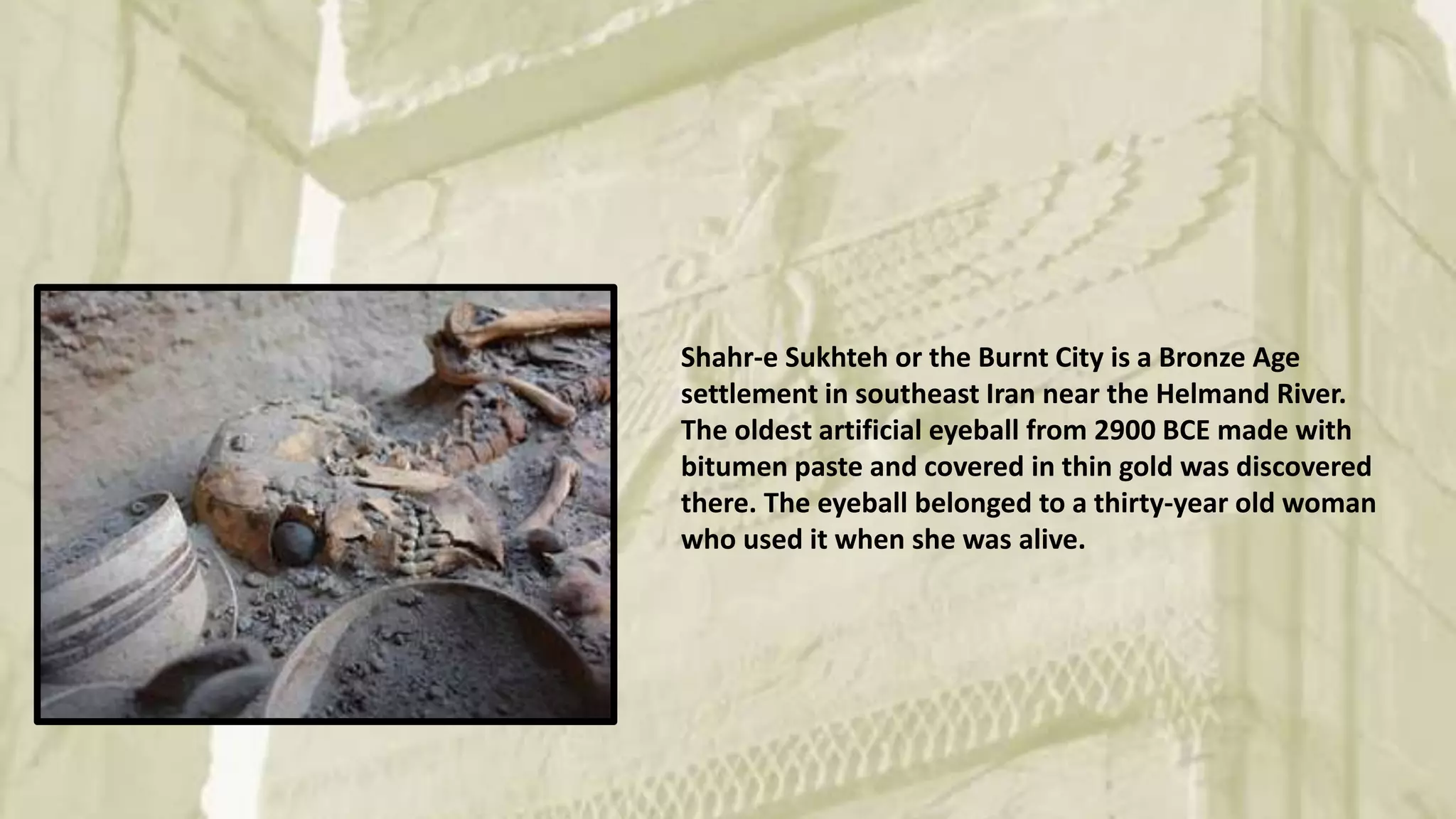 Shahr-e Sukhteh or the Burnt City is a Bronze Age
settlement in southeast Iran near the Helmand River.
The oldest artificial eyeball from 2900 BCE made with
bitumen paste and covered in thin gold was discovered
there. The eyeball belonged to a thirty-year old woman
who used it when she was alive.
 