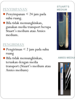 PENYIMPANAN
Penyimpanan < 24 jam pada
suhu ruang.
Bila tidak memungkinkan,
gunakan media transport berupa
Stuart’s medium atau Amies
medium.
PENGIRIMAN
Pengiriman < 2 jam pada suhu
ruang
Bila tidak memungkinkan,
teruskan dengan media
transport (Stuart’s medium atau
Amies medium)
STUART’S
MEDIUM
AMIES MEDIUM
 