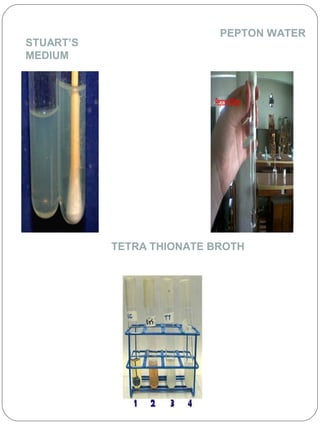 STUART’S
MEDIUM
PEPTON WATER
TETRA THIONATE BROTH
 