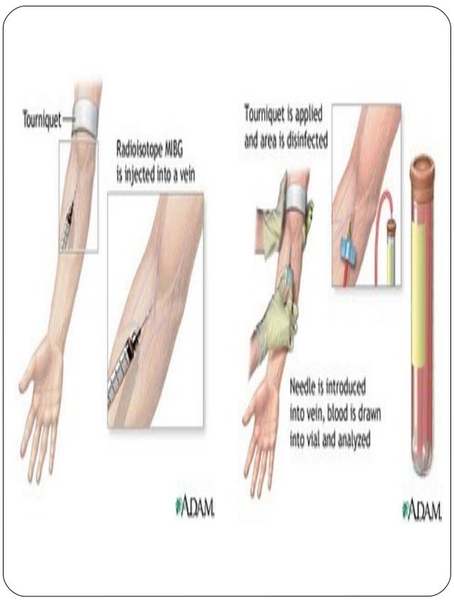 Persiapan Pengambilan Spesimen Bag 4