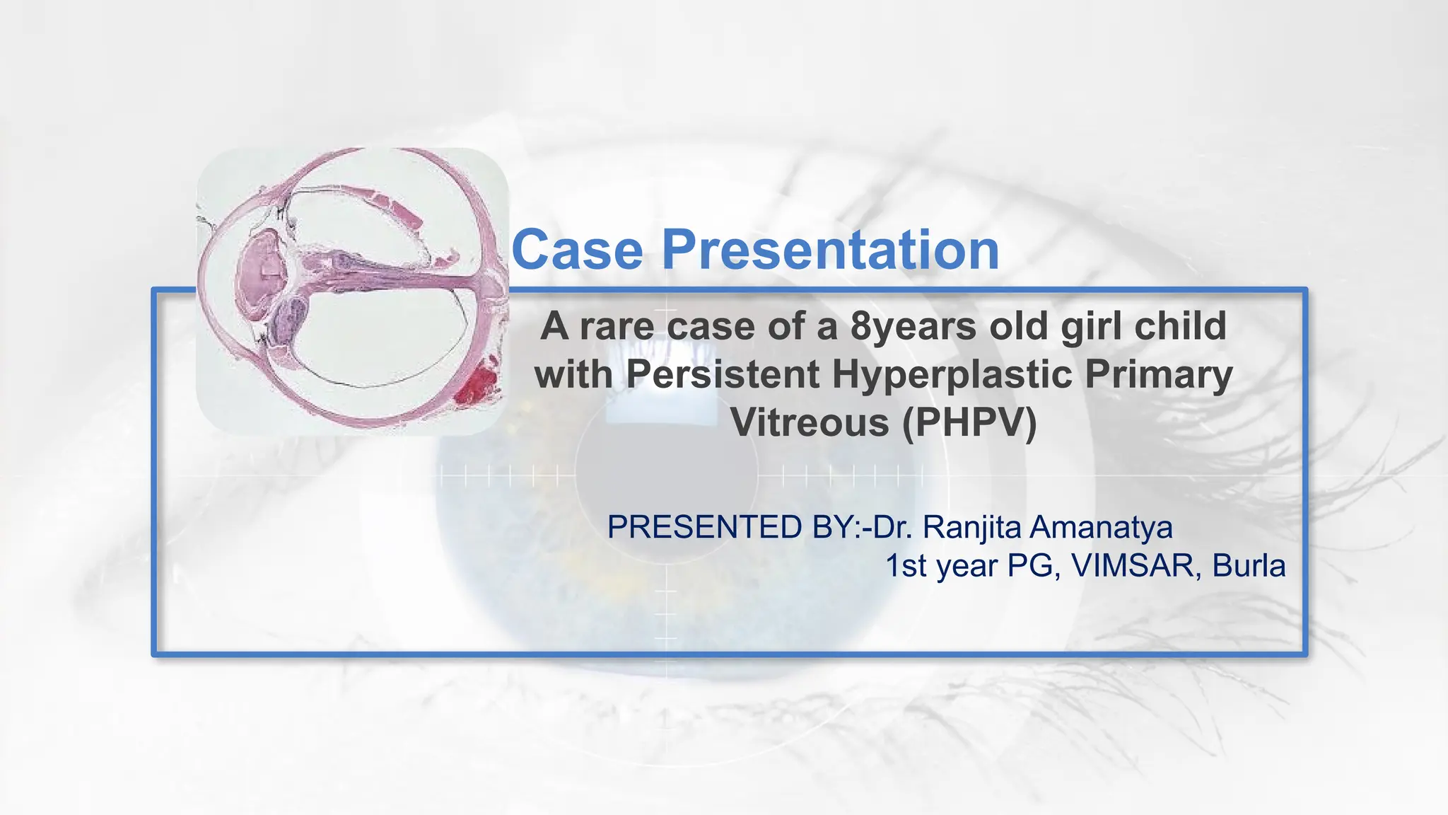 Pphpv Eye Persistent Hyperplastic Primary Vitreous.pptx