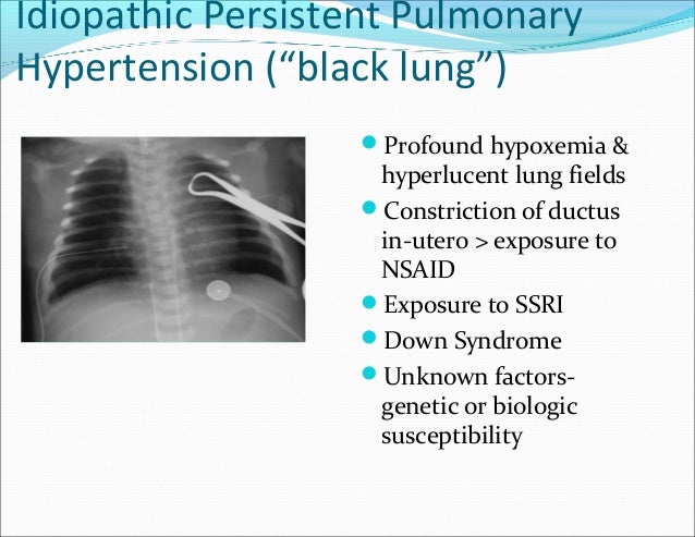 Persistent pulmonary hypertension of the newborn