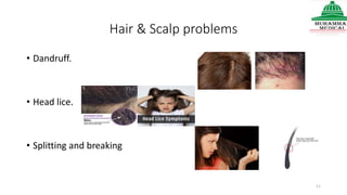 Hair & Scalp problems
• Dandruff.
• Head lice.
• Splitting and breaking
11
 