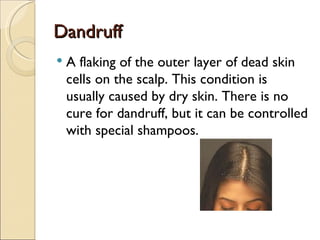 Dandruff
   A flaking of the outer layer of dead skin
    cells on the scalp. This condition is
    usually caused by dry skin. There is no
    cure for dandruff, but it can be controlled
    with special shampoos.
 