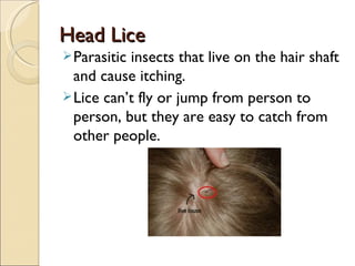 Head Lice
 Parasiticinsects that live on the hair shaft
  and cause itching.
 Lice can’t fly or jump from person to
  person, but they are easy to catch from
  other people.
 