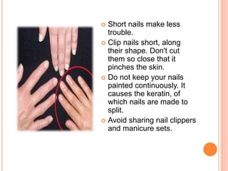  Short nails make less
trouble.
 Clip nails short, along
their shape. Don't cut
them so close that it
pinches the skin.
 Do not keep your nails
painted continuously. It
causes the keratin, of
which nails are made to
split.
 Avoid sharing nail clippers
and manicure sets.
 
