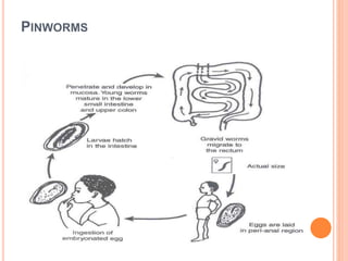 PINWORMS
 