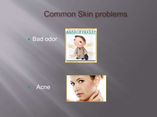  Bad odor
 Acne
 