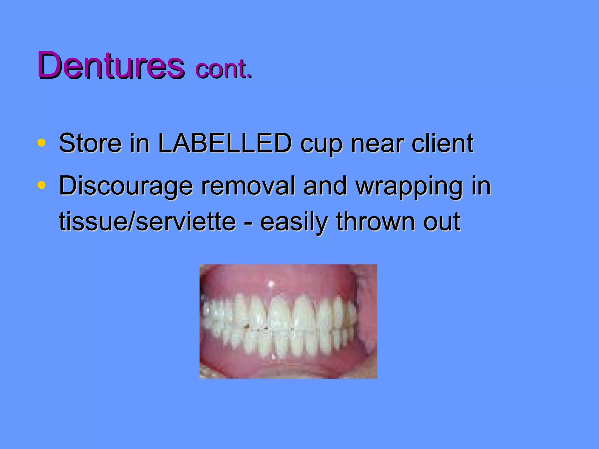 Dentures  cont. Store in LABELLED cup near client Discourage removal and wrapping in tissue/serviette - easily thrown out 