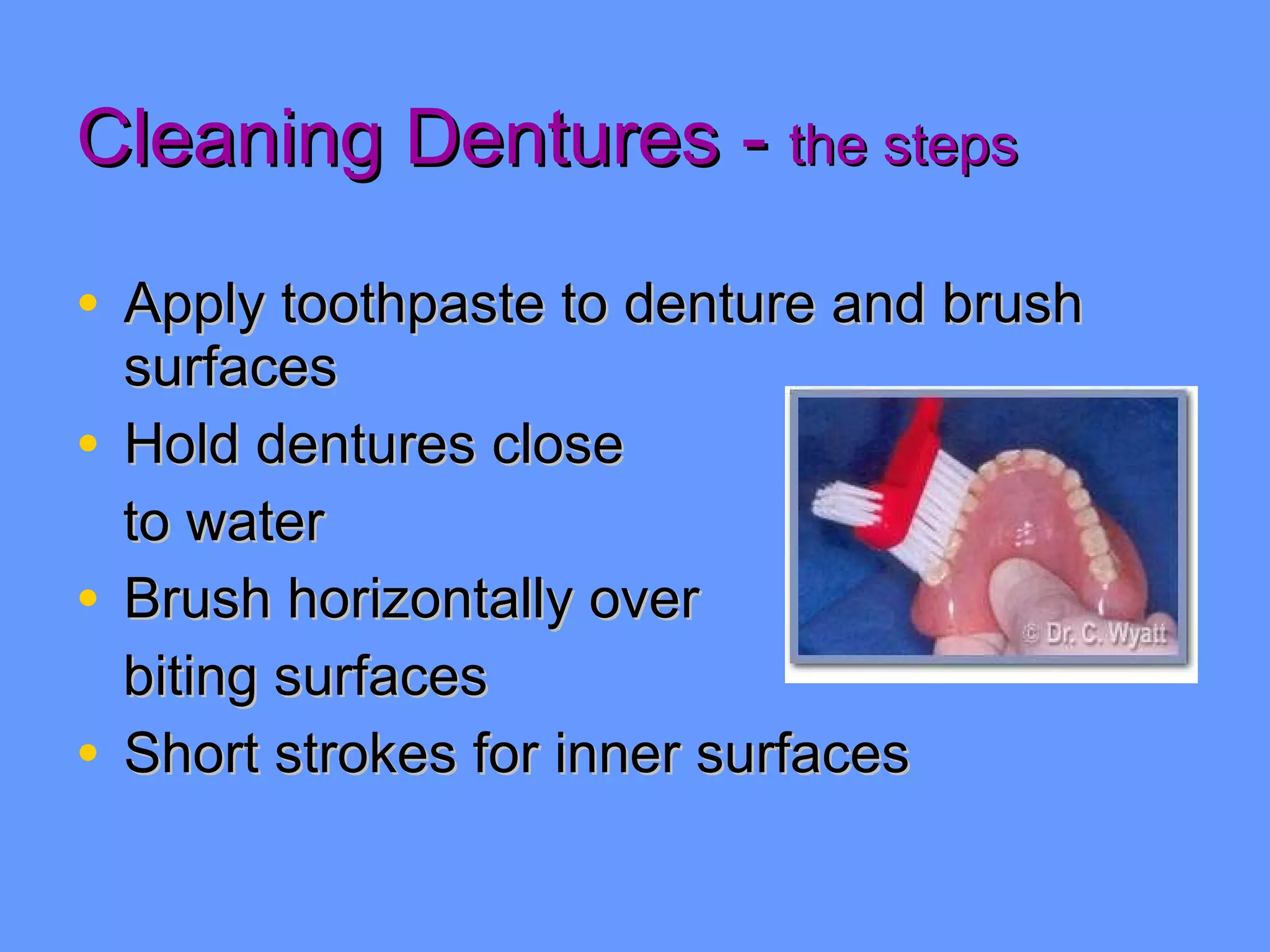 Cleaning Dentures -  the steps Apply toothpaste to denture and brush surfaces Hold dentures close to water Brush horizontally over biting surfaces Short strokes for inner surfaces 
