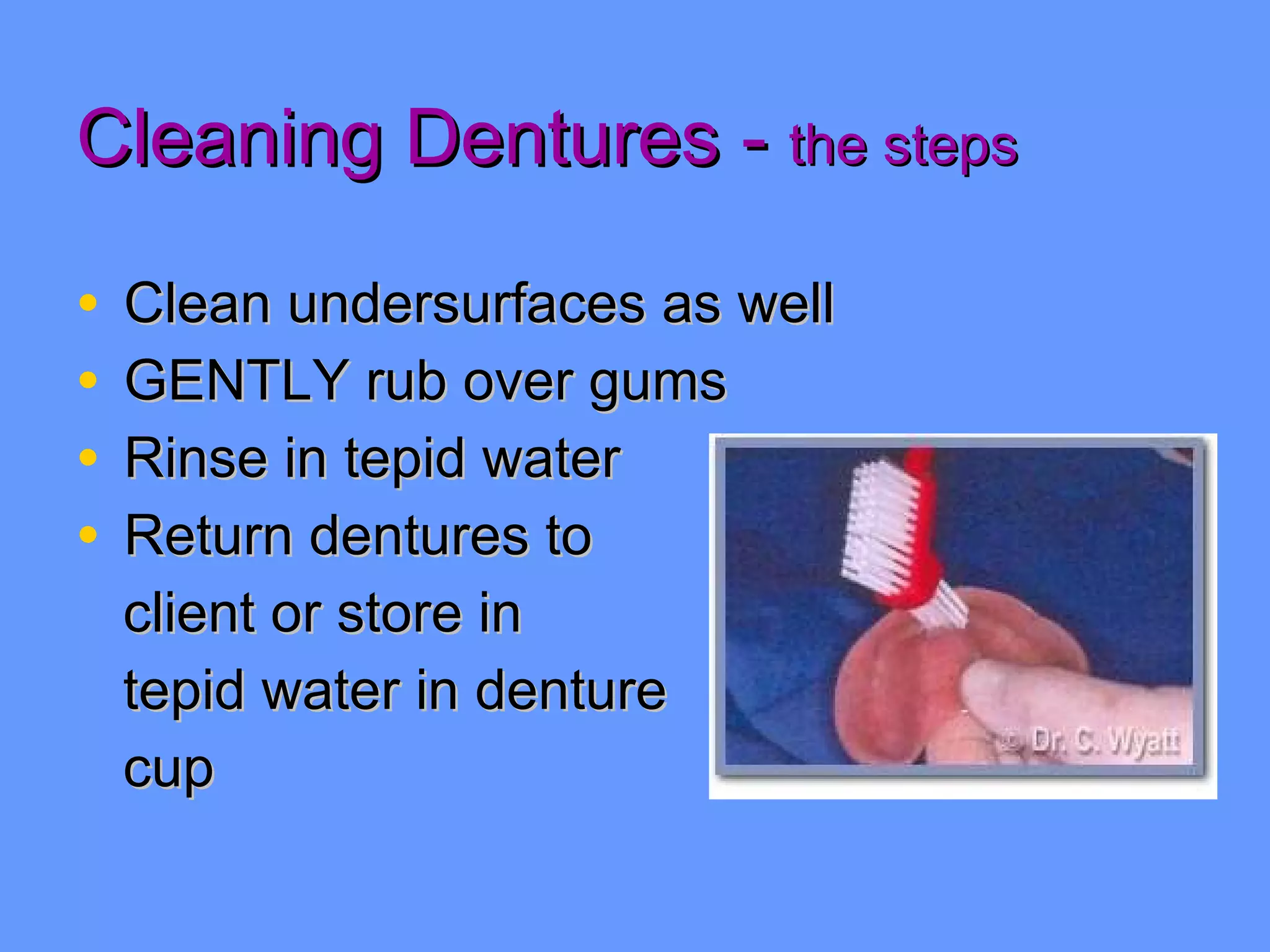 Cleaning Dentures -  the steps Clean undersurfaces as well GENTLY rub over gums Rinse in tepid water Return dentures to  client or store in tepid water in denture cup 