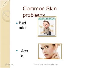 Common Skin
problems
 Bad
odor
 Acn
e
2/6/2020 Yasser Elsnosy HSE Trainer
 