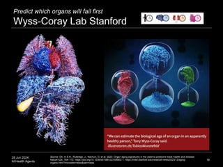 28 Jun 2024
AI Health Agents
Predict which organs will fail first
Wyss-Coray Lab Stanford
18
Source: Oh, H.S.H., Rutledge, J., Nachun, D. et al. 2023. Organ aging signatures in the plasma proteome track health and disease.
Nature 624, 164–172. https://doi.org/10.1038/s41586-023-06802-1. https://med.stanford.edu/news/all-news/2023/12/aging-
organs.html?microsite=news&tab=news
 