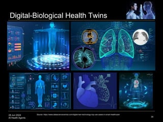 28 Jun 2024
AI Health Agents
Digital-Biological Health Twins
39
Source: https://www.datasciencecentral.com/digital-twin-technology-top-use-cases-in-smart-healthcare/
 