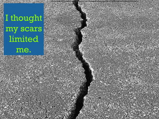 I thought
my scars
limited
me.
N
https://www.ﬂickr.com/photos/deanhochman/14415831884/in/photolist-nXSUzA-qabANK-6eZqak-qR5zoP-L5Wt7-5mYYzd-qR7mf8-jECNK-5YQKNJ-2hLf9-6HHFkc-78eD-r6e
 