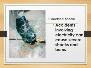 • Electrical Shocks
• Accidents
involving
electricity can
cause severe
shocks and
burns
 