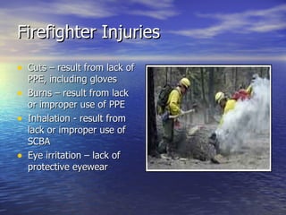 Firefighter Injuries
• Cuts – result from lack of
    PPE, including gloves
•   Burns – result from lack
    or improper use of PPE
•   Inhalation - result from
    lack or improper use of
    SCBA
•   Eye irritation – lack of
    protective eyewear
 