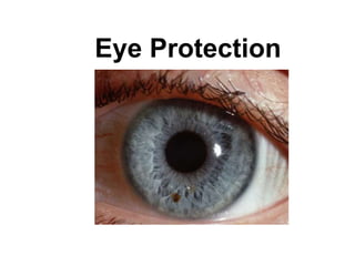 Eye Protection
11
 