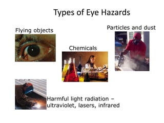 Types of Eye Hazards
Chemicals
Flying objects
Particles and dust
Harmful light radiation –
ultraviolet, lasers, infrared
12
 