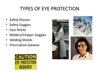 TYPES OF EYE PROTECTION
• Safety Glasses
• Safety Goggles
• Face Shield
• Welders/Chipper Goggles
• Welding Shields
• Prescription Eyewear
13
 