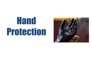 Hand
Protection
 