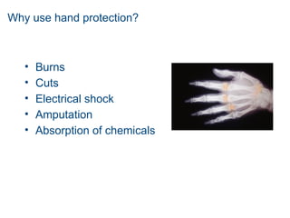 Why use hand protection?
• Burns
• Cuts
• Electrical shock
• Amputation
• Absorption of chemicals
 