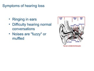 Symptoms of hearing loss
• Ringing in ears
• Difficulty hearing normal
conversations
• Noises are "fuzzy" or
muffled
 