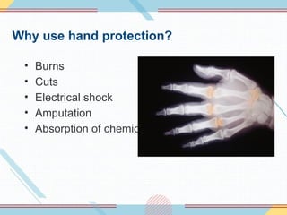 Why use hand protection?
• Burns
• Cuts
• Electrical shock
• Amputation
• Absorption of chemicals
 