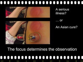 >> 0 >> 1 >> 2 >> 3 >> 4 >>
The focus determines the observation
A serious
illness?
… or
An Asian cure?
 