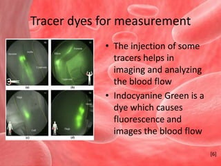 Tracer dyes for measurementThe injection of some tracers helps in imaging and analyzing the blood flowIndocyanine Green is a dye which causes fluorescence and images the blood flow  [6]